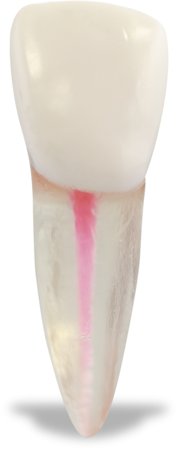 Real‑T Endo Maxillary Right Central Incisor (Radiolucent)