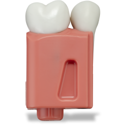 Real‑T Endo Tooth #14 in Breakaway Insert (Radiolucent)